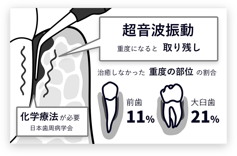 従来の歯周病治療